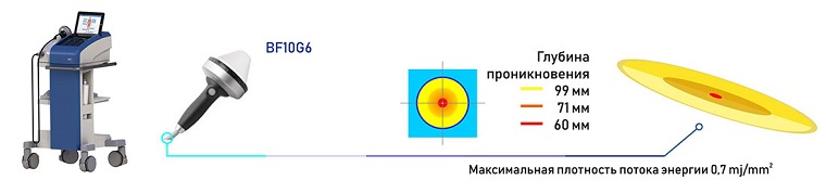PiezoWave_2_FB10_G6(1)